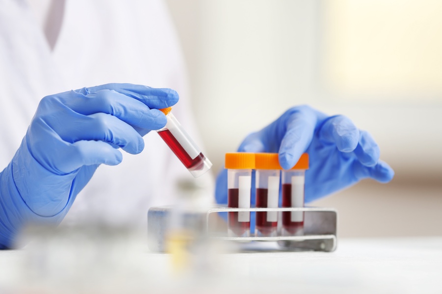 Gloved hands handling a blood sample tube over a rack of labeled vials in a lab setting