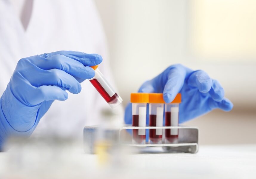 Gloved hands handling a blood sample tube over a rack of labeled vials in a lab setting